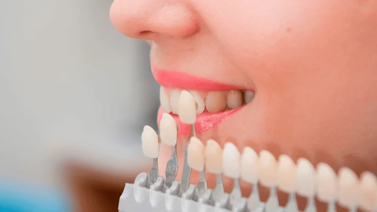 Clínica Estética Dental en Madrid