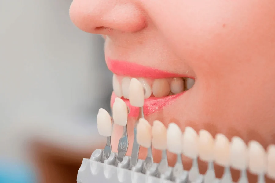 Clínica Estética Dental en Madrid